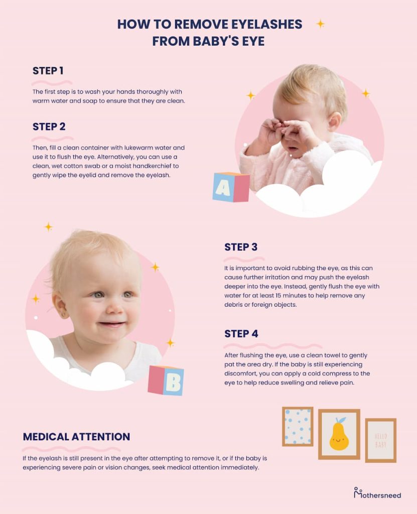 Step by step guide on how to remove eyelashes from baby's eye